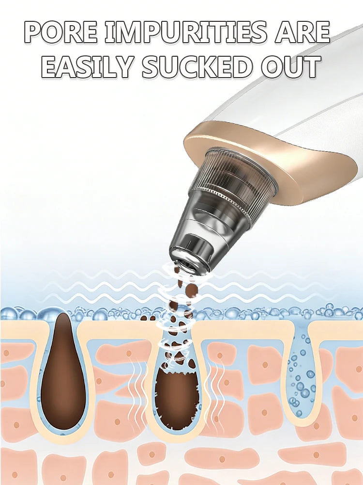 Precision Deep Pore Extraction Tool