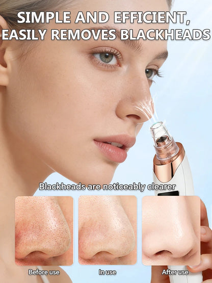 Precision Deep Pore Extraction Tool