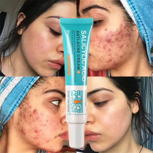 Advanced Pore Refining Acne Treatment